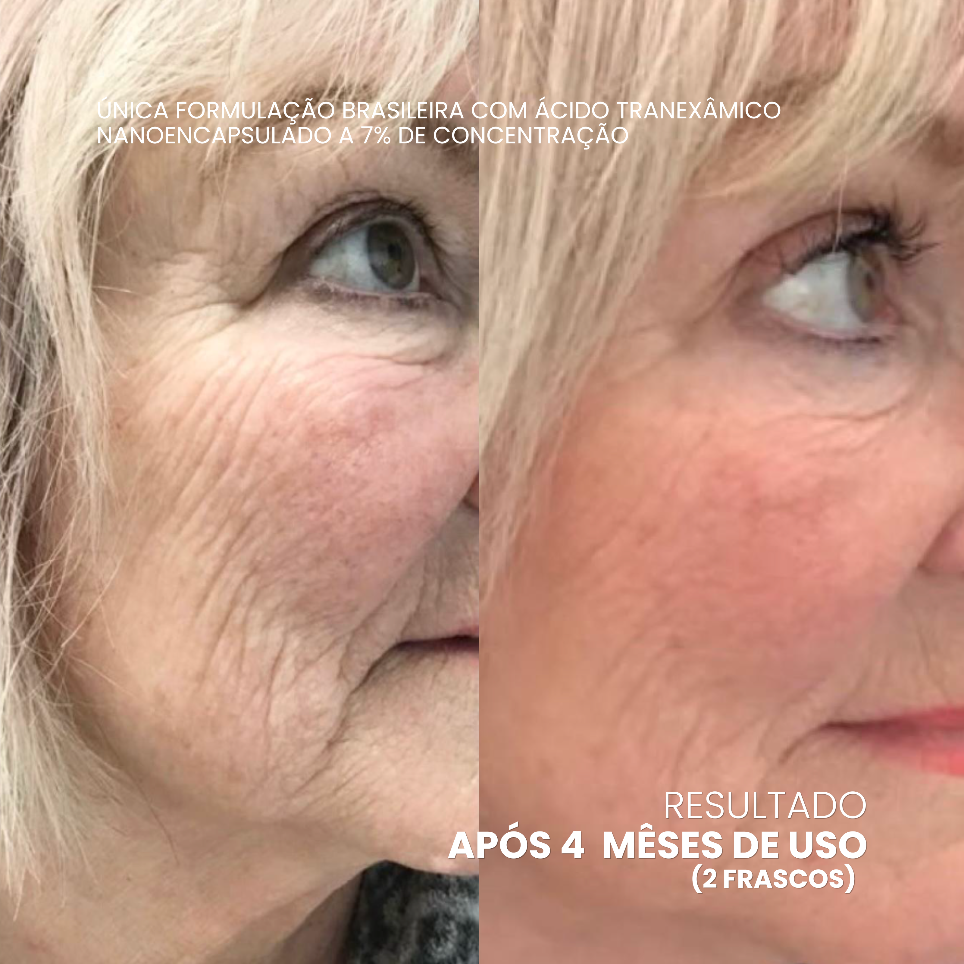 EXOMAGE — Creme Rejuvenescedor Anti-Idade com PDRN REAL