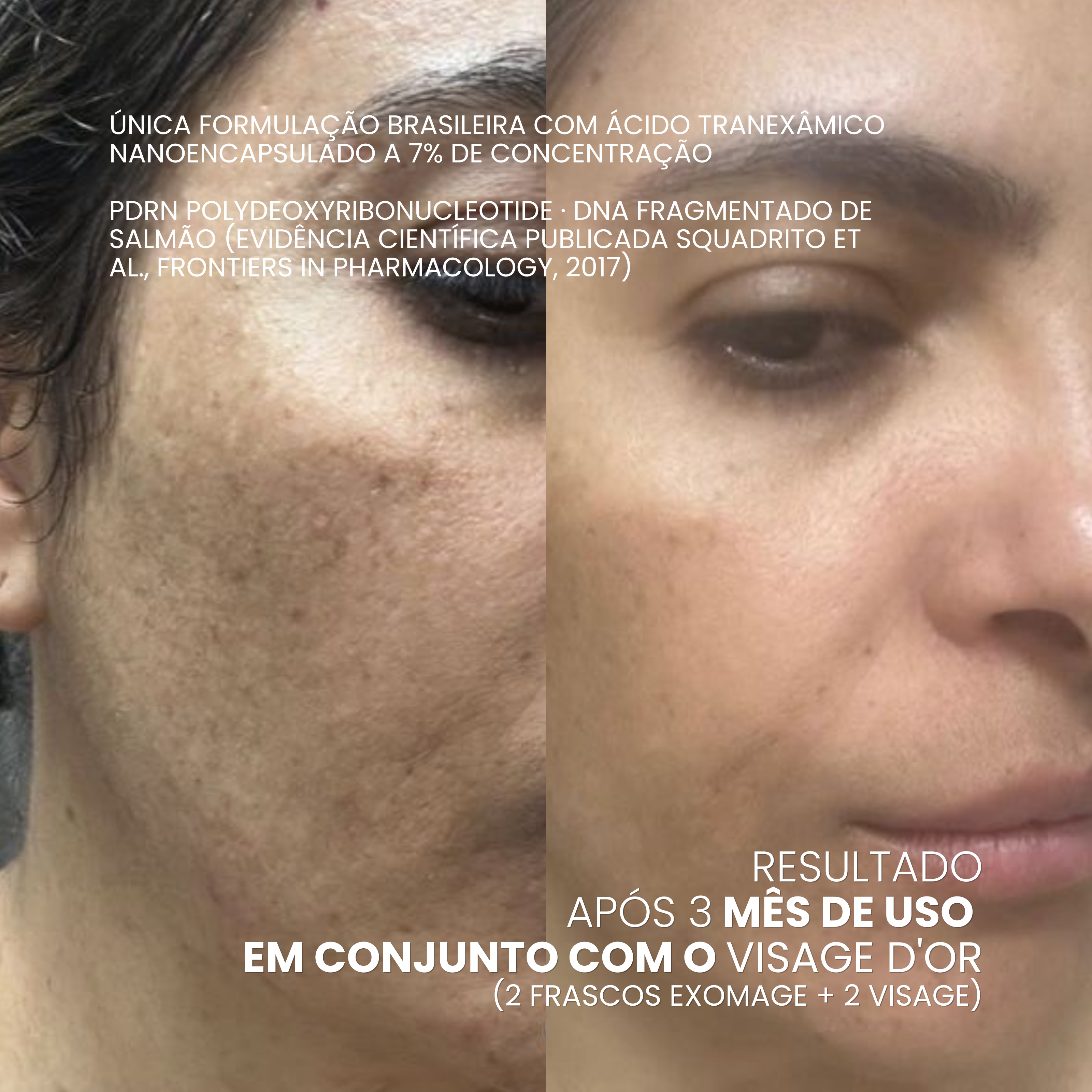 EXOMAGE — Creme Rejuvenescedor Anti-Idade com PDRN REAL