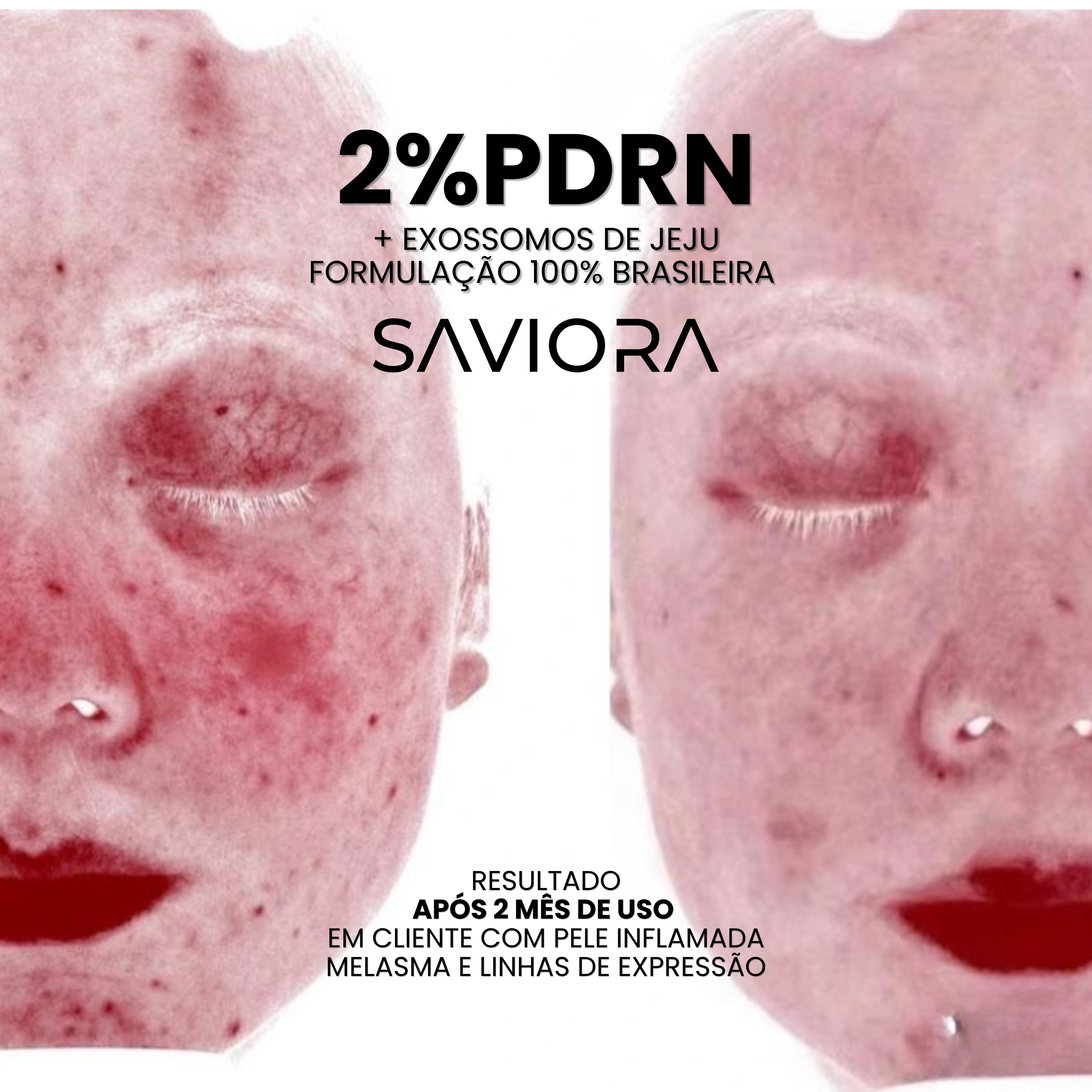 EXOMAGE — Creme Rejuvenescedor Anti-Idade com PDRN REAL