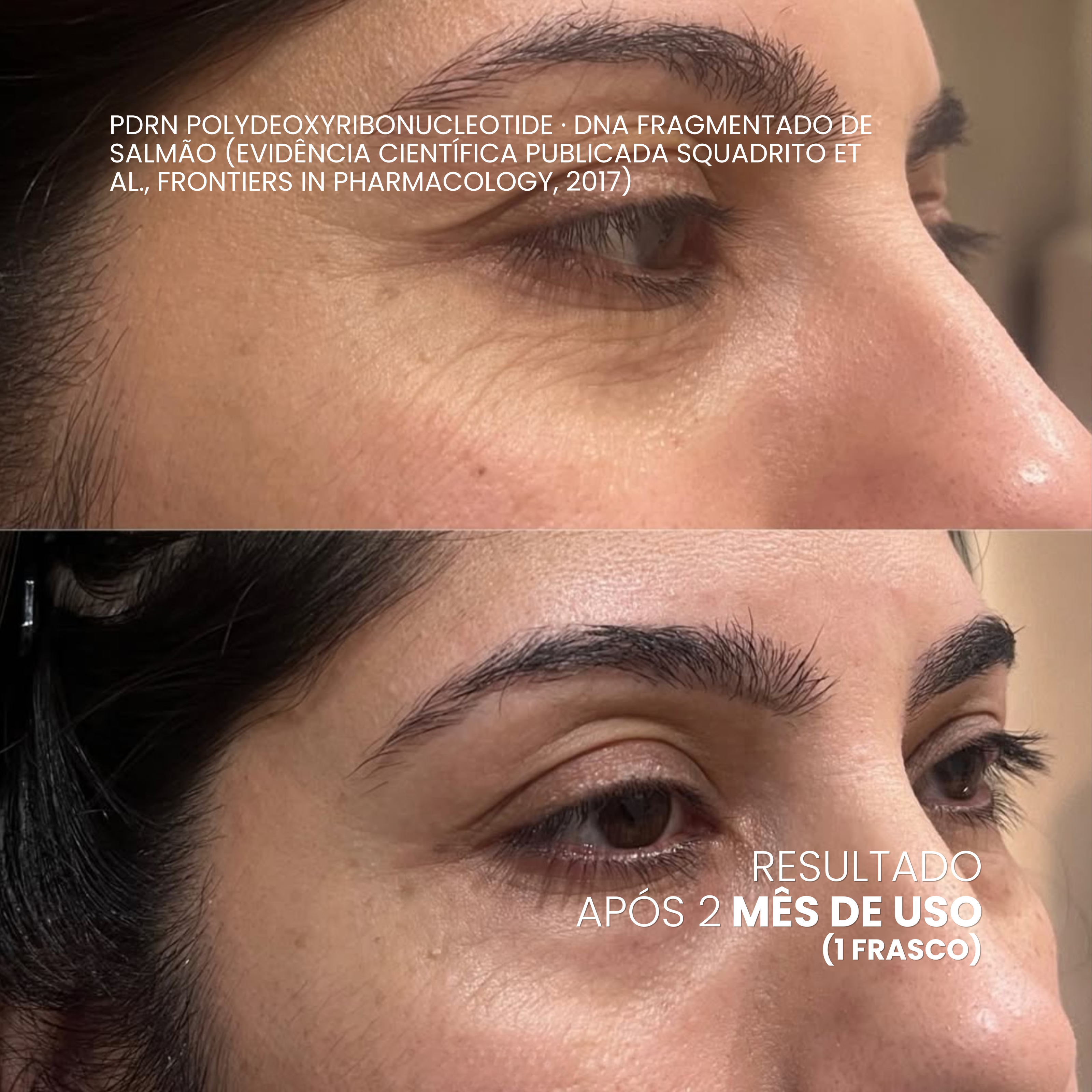EXOMAGE — Creme Rejuvenescedor Anti-Idade com PDRN REAL