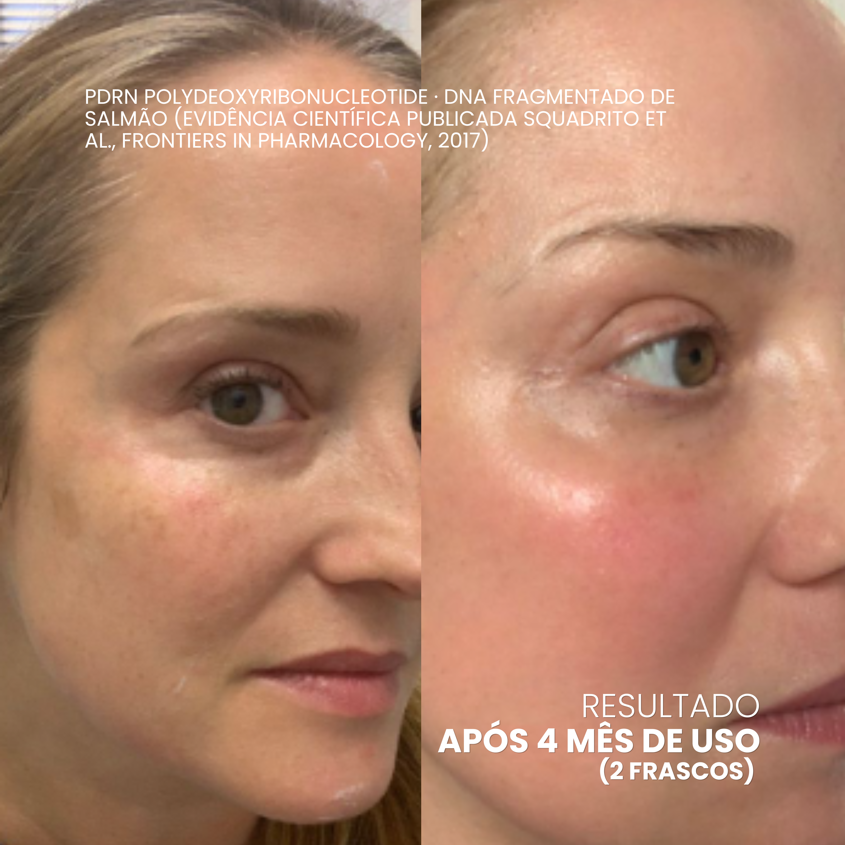 EXOMAGE — Creme Rejuvenescedor Anti-Idade com PDRN REAL
