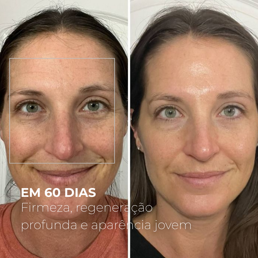 EXOMAGE — DNA ativador de juventude em booster de PDRN com Exossomos