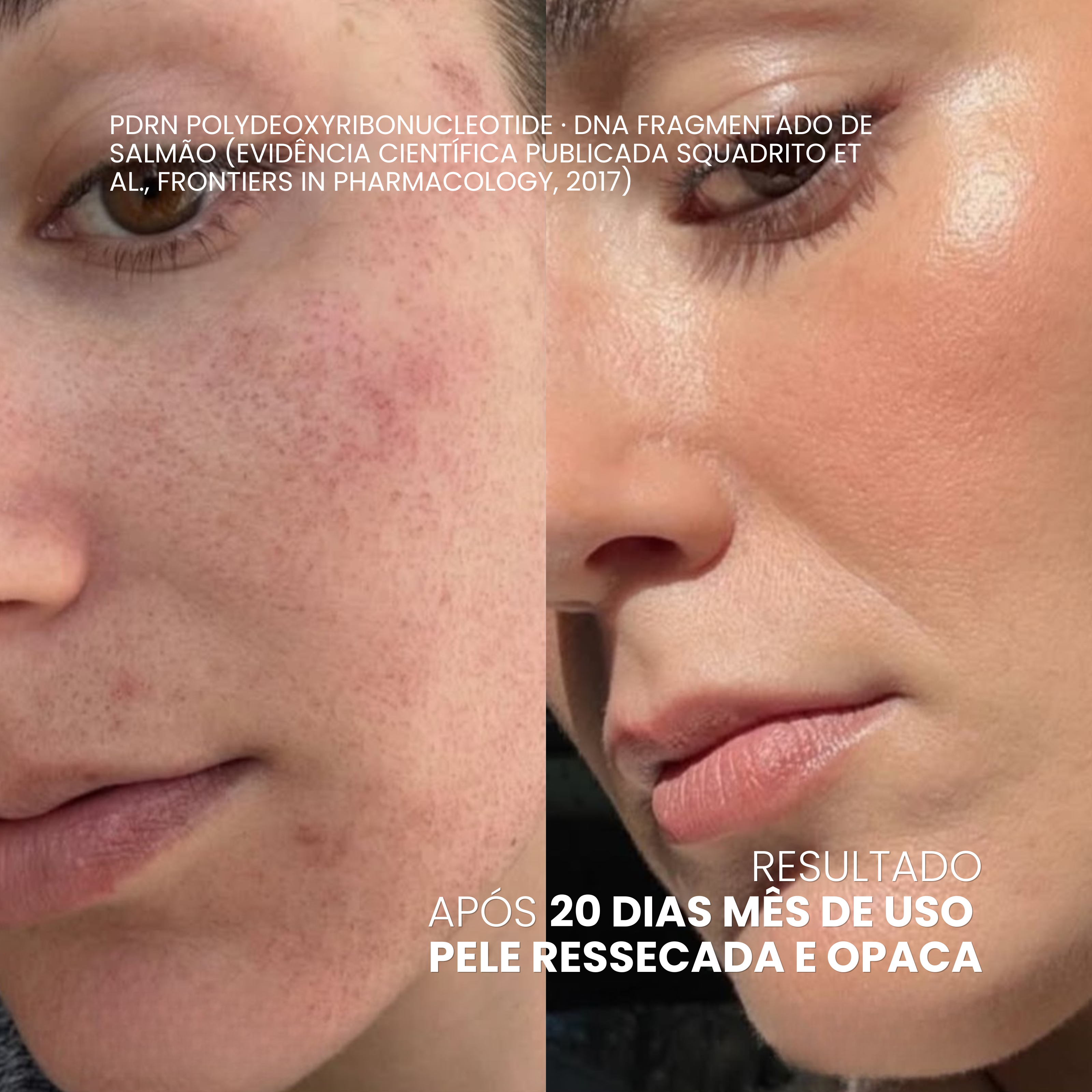 EXOMAGE — Creme Rejuvenescedor Anti-Idade com PDRN REAL