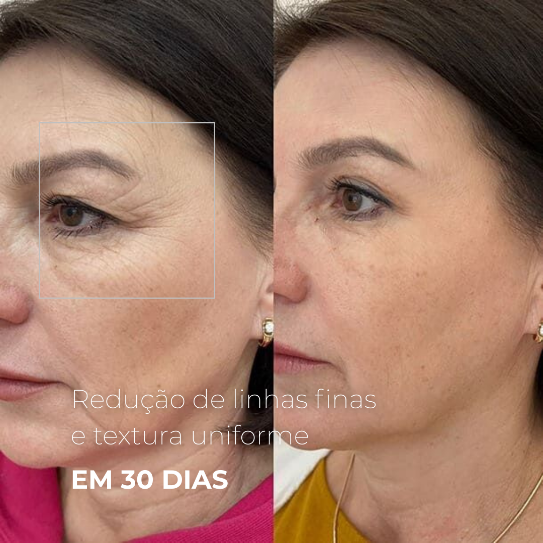 EXOMAGE — DNA ativador de juventude em booster de PDRN com Exossomos