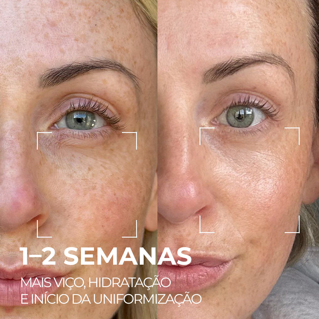 VISAGE D’OR – Sérum Clareador com TXA & Tecnologia BioSync³™