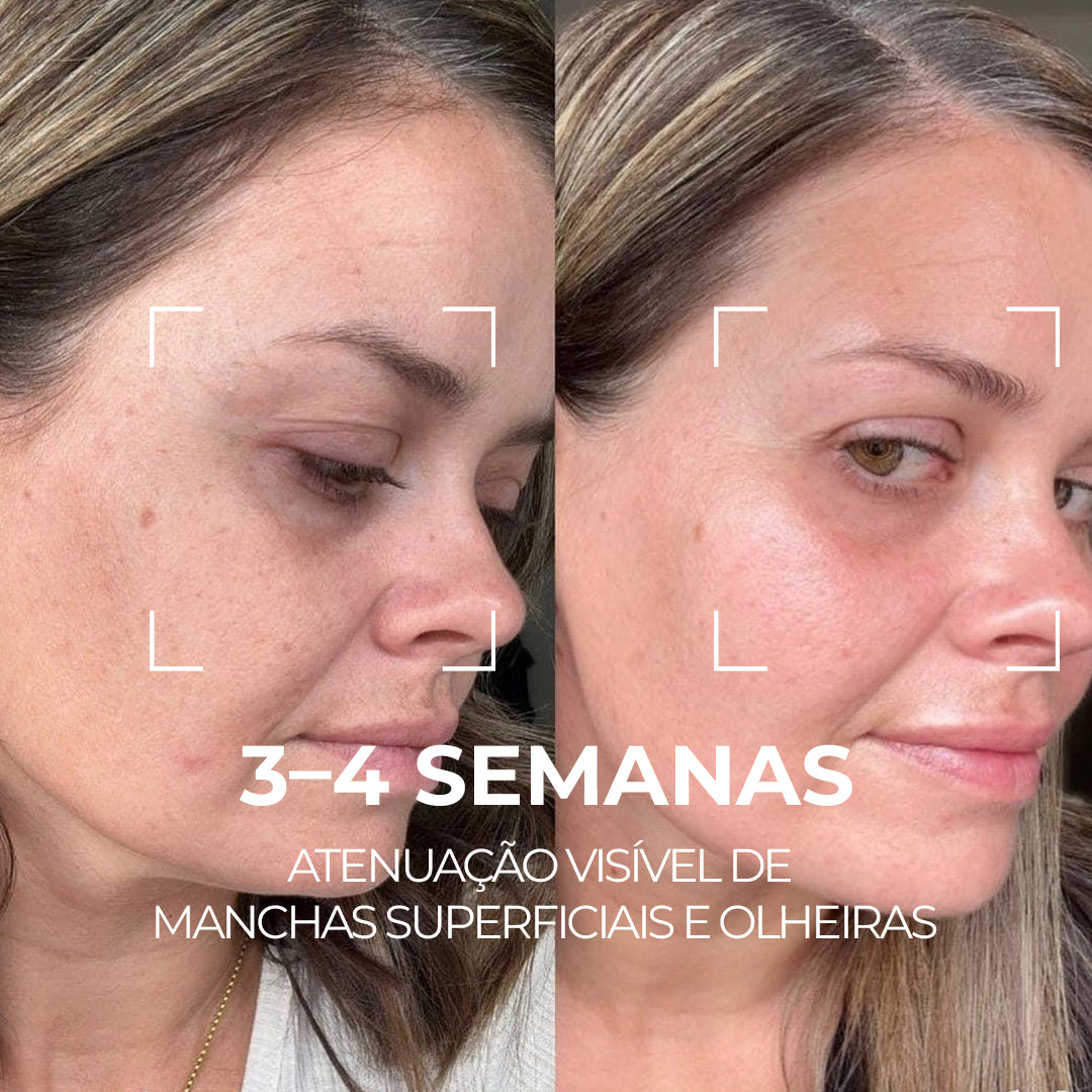 VISAGE D’OR – Sérum Clareador com TXA & Tecnologia BioSync³™