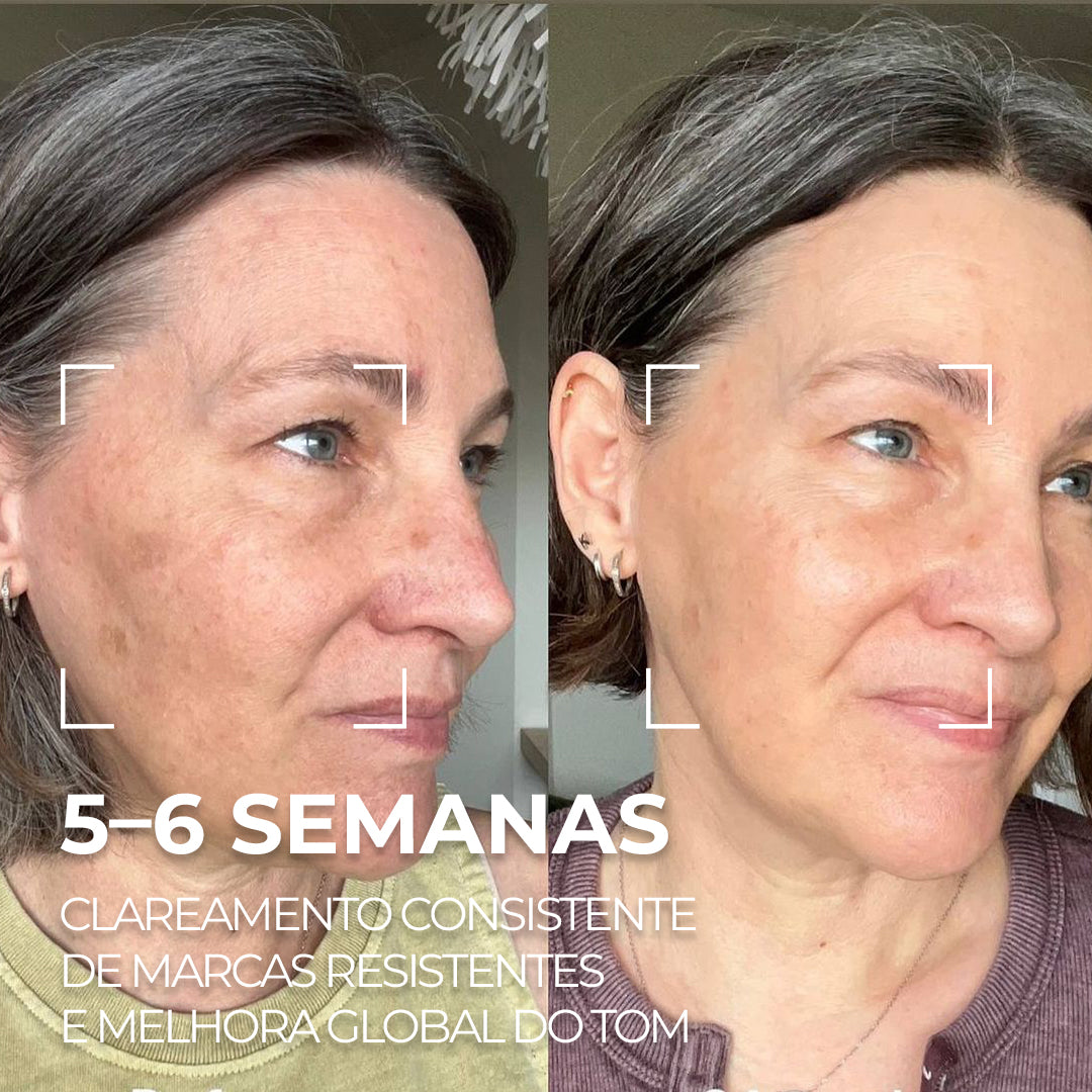 VISAGE D’OR – Sérum Clareador com TXA & Tecnologia BioSync³™