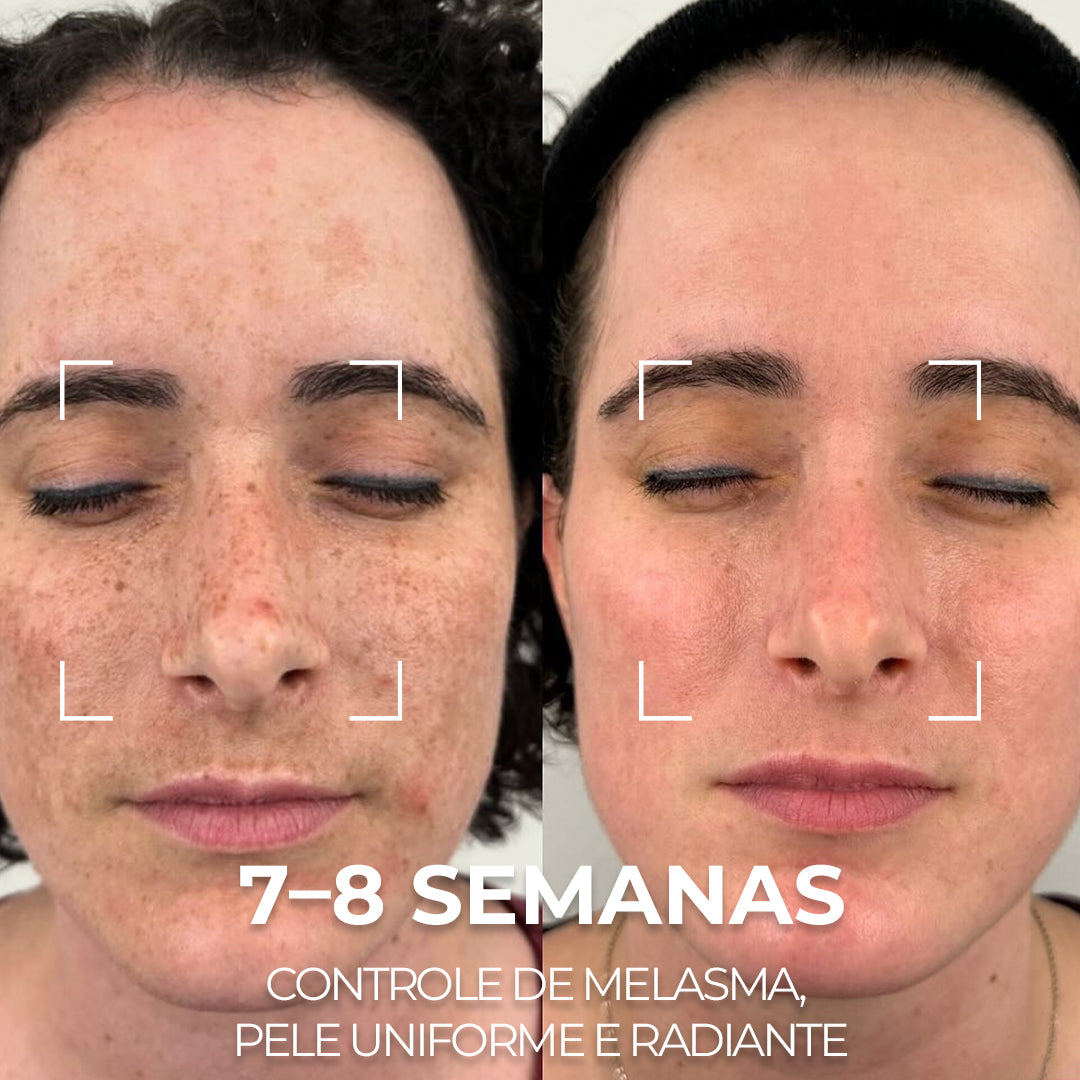 VISAGE D’OR – Sérum Clareador com TXA & Tecnologia BioSync³™
