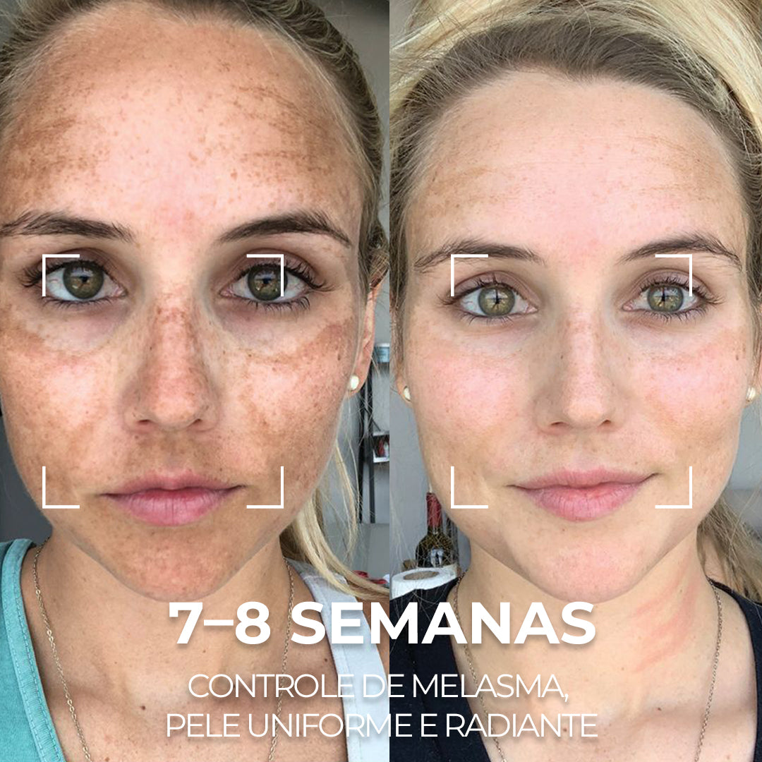 VISAGE D’OR – Sérum Clareador com TXA & Tecnologia BioSync³™